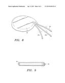 Extracellular Matrix Encasement Structures and Methods diagram and image