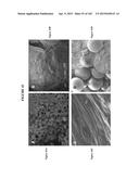 BIOMIMMETIC NANOFIBER SCAFFOLD FOR SOFT TISSUE AND SOFT TISSUE-TO-BONE     REPAIR, AUGMENTATION AND REPLACEMENT diagram and image