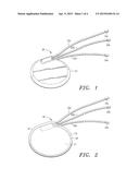 Extracellular Matrix Encasement Structures and Methods diagram and image