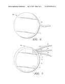 Extracellular Matrix Encasement Structures and Methods diagram and image