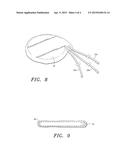 Extracellular Matrix Encasement Structures and Methods diagram and image