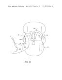 SYSTEMS AND METHODS FOR PROVIDING AN ERGONOMIC CAR SEAT AND HANDLE diagram and image