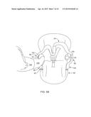 SYSTEMS AND METHODS FOR PROVIDING AN ERGONOMIC CAR SEAT AND HANDLE diagram and image