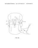 SYSTEMS AND METHODS FOR PROVIDING AN ERGONOMIC CAR SEAT AND HANDLE diagram and image