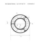 Acoustic Noise Reducing RF Coil For Magnetic Resonance Imaging diagram and image