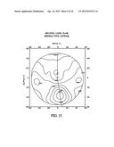 Process For Determining A Pair Of Progressive Ophthalmic Lenses diagram and image