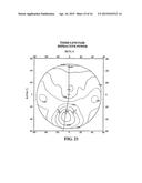 Process For Determining A Pair Of Progressive Ophthalmic Lenses diagram and image