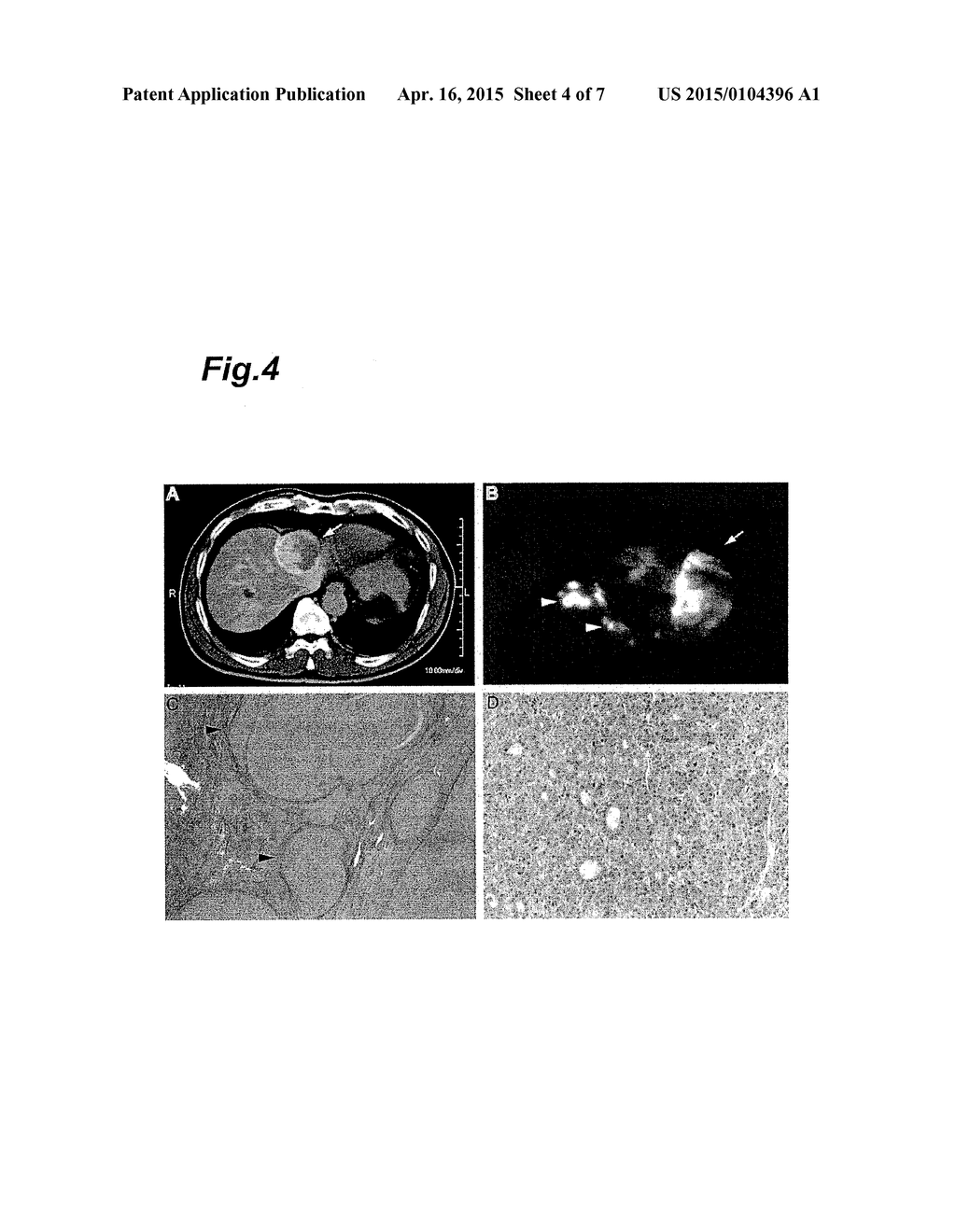 METHOD FOR DETECTING CANCER USING ICG FLUORESCENCE METHOD - diagram, schematic, and image 05