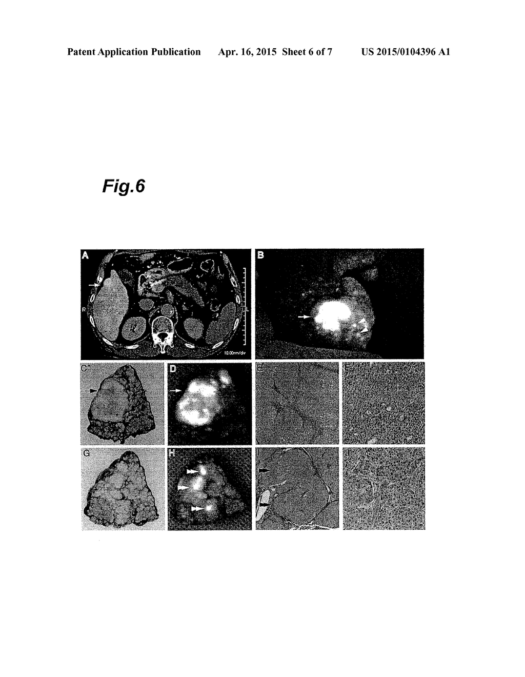 METHOD FOR DETECTING CANCER USING ICG FLUORESCENCE METHOD - diagram, schematic, and image 07