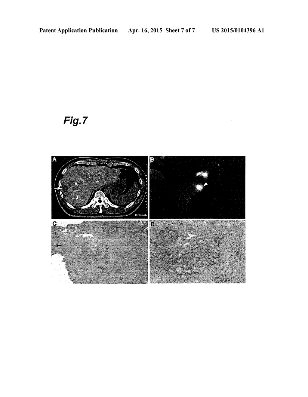 METHOD FOR DETECTING CANCER USING ICG FLUORESCENCE METHOD - diagram, schematic, and image 08