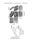 METAP-2 INHIBITOR POLYMERSOMES FOR THERAPEUTIC ADMINISTRATION diagram and image