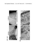 METAP-2 INHIBITOR POLYMERSOMES FOR THERAPEUTIC ADMINISTRATION diagram and image