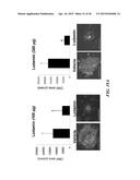 METAP-2 INHIBITOR POLYMERSOMES FOR THERAPEUTIC ADMINISTRATION diagram and image