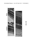 METAP-2 INHIBITOR POLYMERSOMES FOR THERAPEUTIC ADMINISTRATION diagram and image