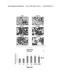 Materials and Methods Useful for Affecting Tumor Cell Growth, Migration     and Invasion diagram and image