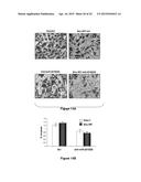 Materials and Methods Useful for Affecting Tumor Cell Growth, Migration     and Invasion diagram and image