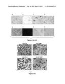 Materials and Methods Useful for Affecting Tumor Cell Growth, Migration     and Invasion diagram and image