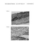 COMPOSITIONS AND METHODS FOR TISSUE REPAIR diagram and image