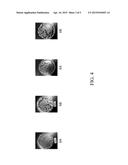 Dissolvable Strip for Treatment of Oral Thermal Burns diagram and image