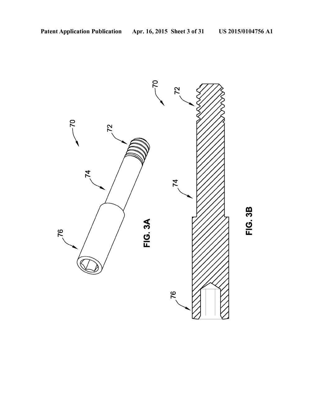 TEMPORARY ABUTMENT WITH COMBINATION OF SCANNING FEATURES AND     PROVISIONALIZATION FEATURES - diagram, schematic, and image 04