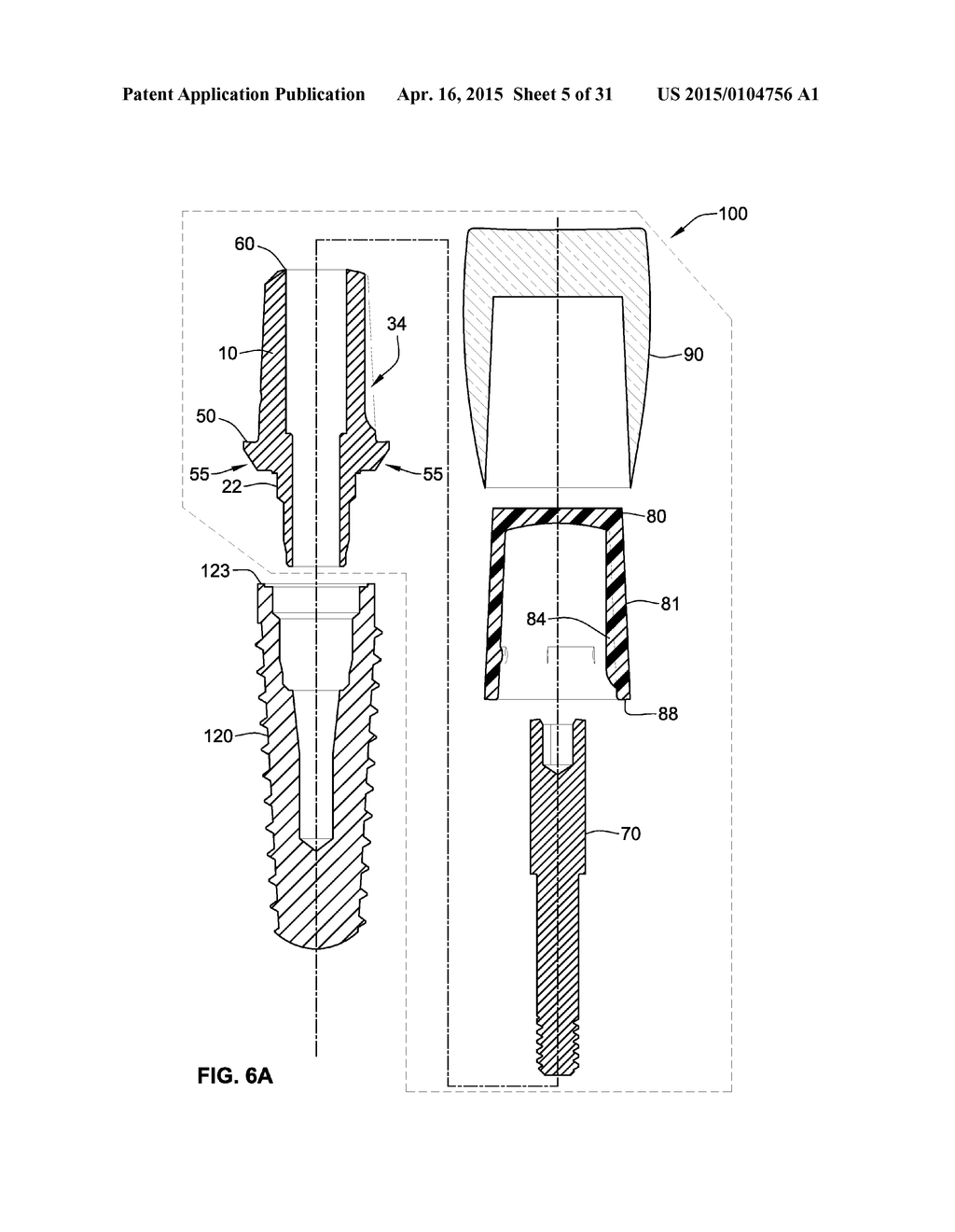 TEMPORARY ABUTMENT WITH COMBINATION OF SCANNING FEATURES AND     PROVISIONALIZATION FEATURES - diagram, schematic, and image 06