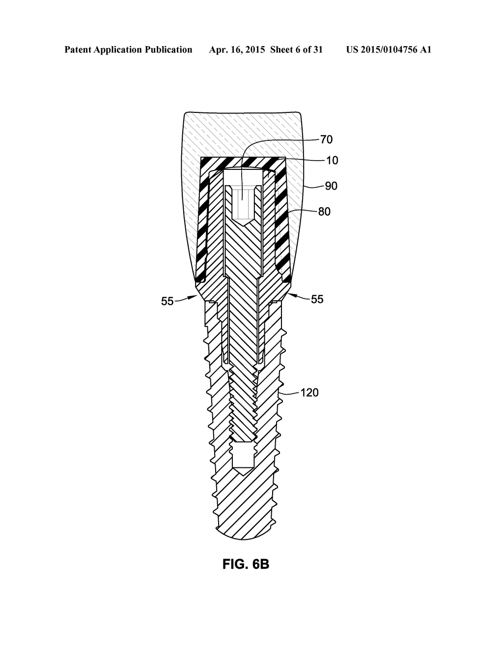 TEMPORARY ABUTMENT WITH COMBINATION OF SCANNING FEATURES AND     PROVISIONALIZATION FEATURES - diagram, schematic, and image 07