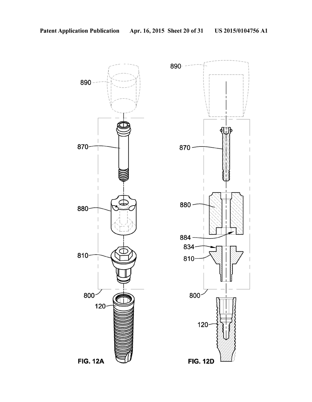 TEMPORARY ABUTMENT WITH COMBINATION OF SCANNING FEATURES AND     PROVISIONALIZATION FEATURES - diagram, schematic, and image 21