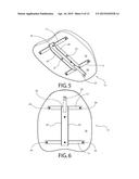 EXERCISE APPARATUS diagram and image