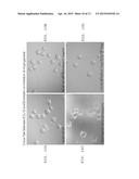 ANTI-ANGIOGENIC TREATMENT OF OVARIAN, BREAST, AND PROSTATE CANCER WITH A     COMBINATION OF ANTAGONISTS diagram and image