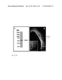 FIDGETIN-LIKE 2 AS A TARGET TO ENHANCE WOUND HEALING diagram and image