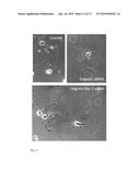 FIDGETIN-LIKE 2 AS A TARGET TO ENHANCE WOUND HEALING diagram and image