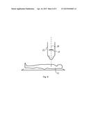 MICROFABRICATED SCINTILLATION DETECTOR diagram and image