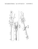 SURGICAL INSTRUMENT GUIDE DEVICE diagram and image