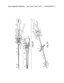 SURGICAL INSTRUMENT GUIDE DEVICE diagram and image