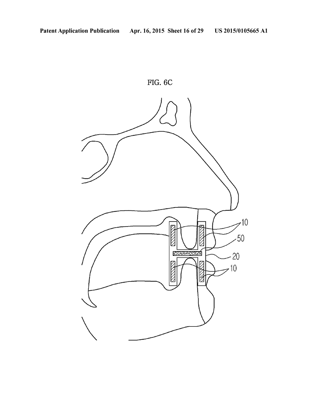 DENTAL ULTRASONIC DIAGNOSTIC APPARATUS - diagram, schematic, and image 17