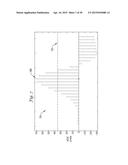 METHOD FOR DISCRIMINATING BETWEEN VENTRICULAR AND SUPRAVENTRICULAR     ARRHYTHMIAS diagram and image