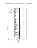 METHOD FOR DISCRIMINATING BETWEEN VENTRICULAR AND SUPRAVENTRICULAR     ARRHYTHMIAS diagram and image