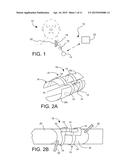 IMPLANTABLE ELECTRODE ASSEMBLY diagram and image