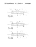 IMPLANTABLE ELECTRODE ASSEMBLY diagram and image