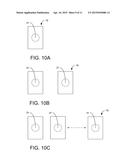 IMPLANTABLE ELECTRODE ASSEMBLY diagram and image