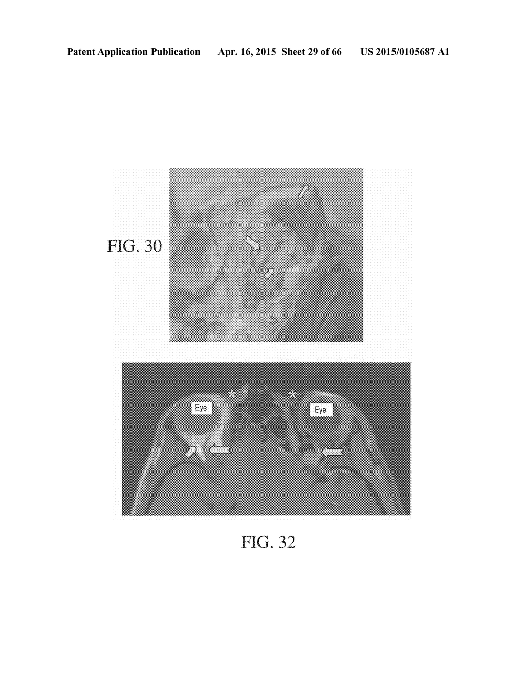 METHOD AND APPARATUS FOR BIOLOGICAL EVALUATION - diagram, schematic, and image 30