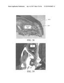 METHOD AND APPARATUS FOR BIOLOGICAL EVALUATION diagram and image