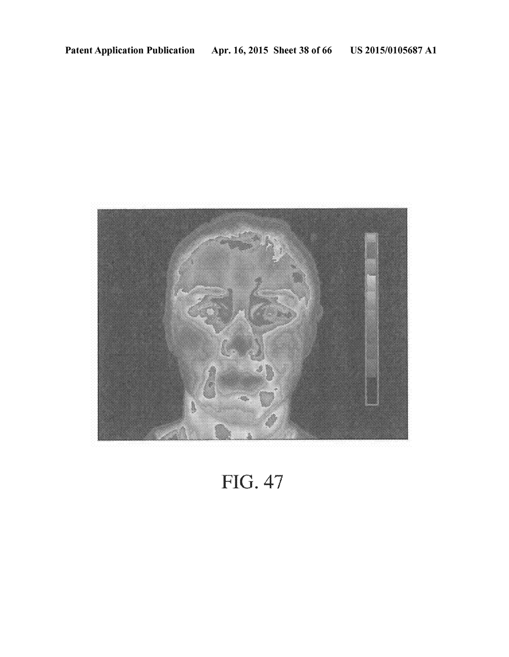 METHOD AND APPARATUS FOR BIOLOGICAL EVALUATION - diagram, schematic, and image 39