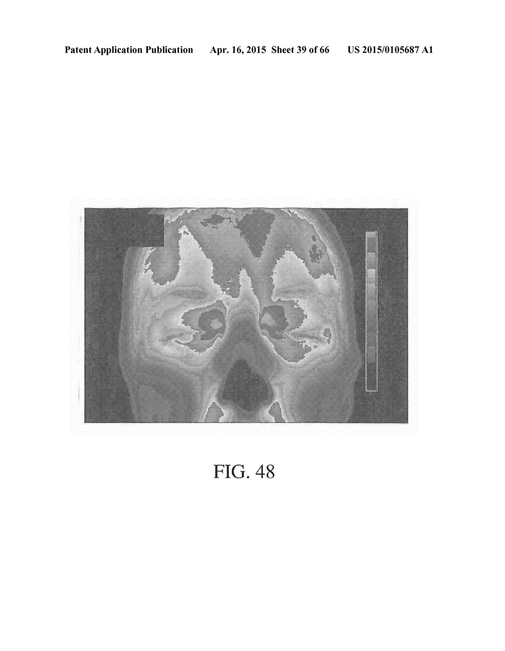 METHOD AND APPARATUS FOR BIOLOGICAL EVALUATION - diagram, schematic, and image 40