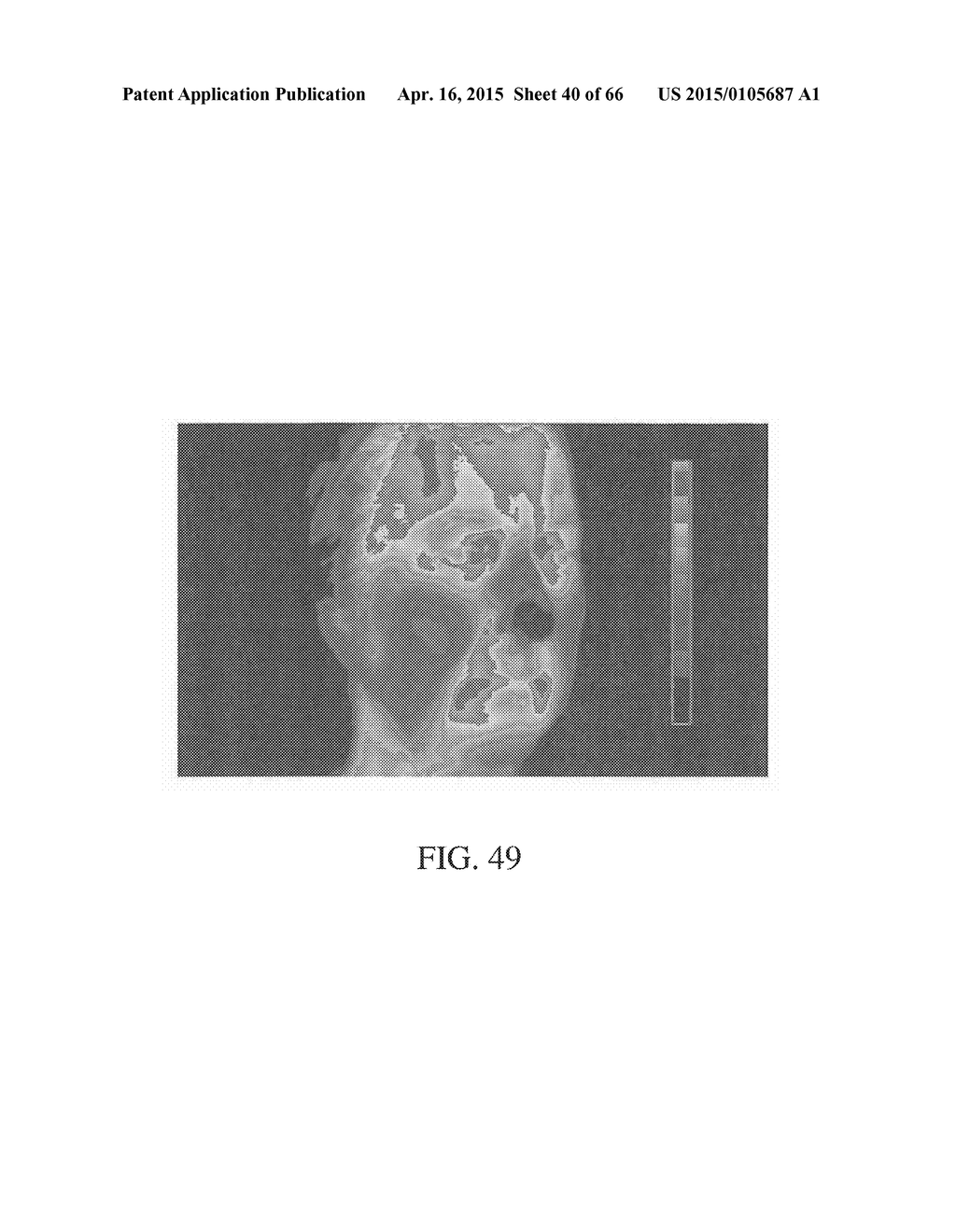 METHOD AND APPARATUS FOR BIOLOGICAL EVALUATION - diagram, schematic, and image 41