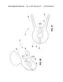 BIOPSY DEVICE diagram and image