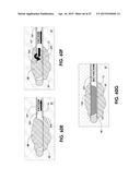 BIOPSY DEVICE diagram and image