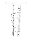 APPARATUS AND METHOD FOR DETECTING DIASTASIS RECTI diagram and image