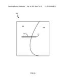 METHOD FOR KNEE RESECTION ALIGNMENT APPROXIMATION IN KNEE REPLACEMENT     PROCEDURES diagram and image