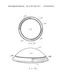 METHOD AND SYSTEM FOR ADJUSTING THE REFRACTIVE POWER OF AN IMPLANTED     INTRAOCULAR LENS diagram and image